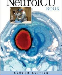 The NeuroICU Book 2nd Edition Kiwon Lee - eBook PDF