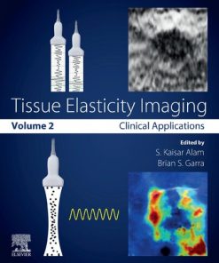 Tissue Elasticity Imaging: Volume 2: Clinical Applications 1st Edition - eBook PDF