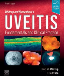 Whitcup and Nussenblatt's Uveitis: Fundamentals and Clinical Practice 5th Edition Scott M. Whitcup Md - eBook PDF