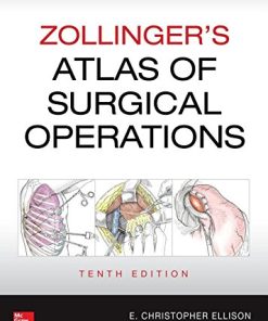 Zollinger’s Atlas of Surgical Operations, Tenth Edition Robert M. Zollinger Jr. - eBook PDF